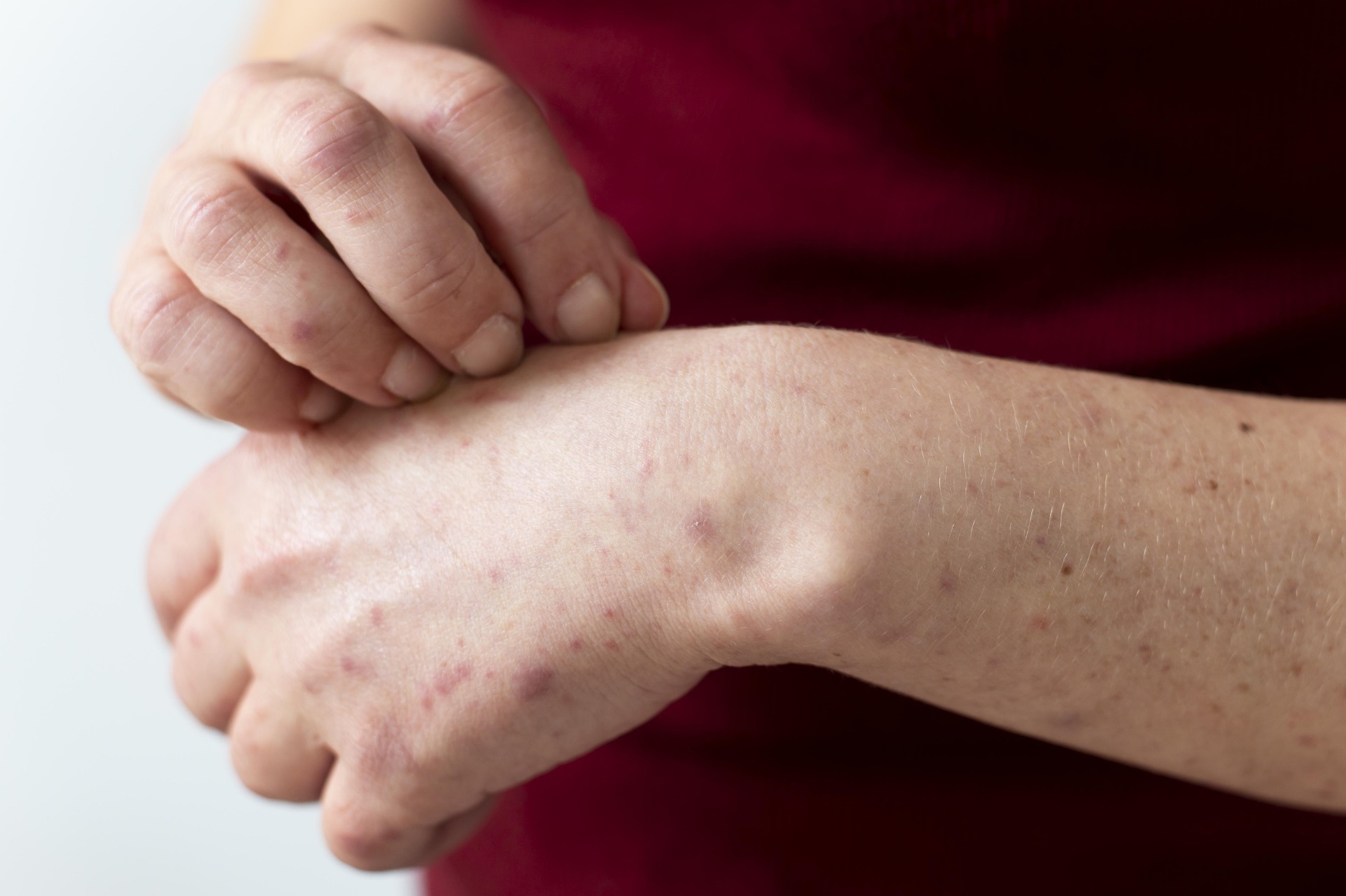 Dermatology and Skin Care | Careplus Compounding