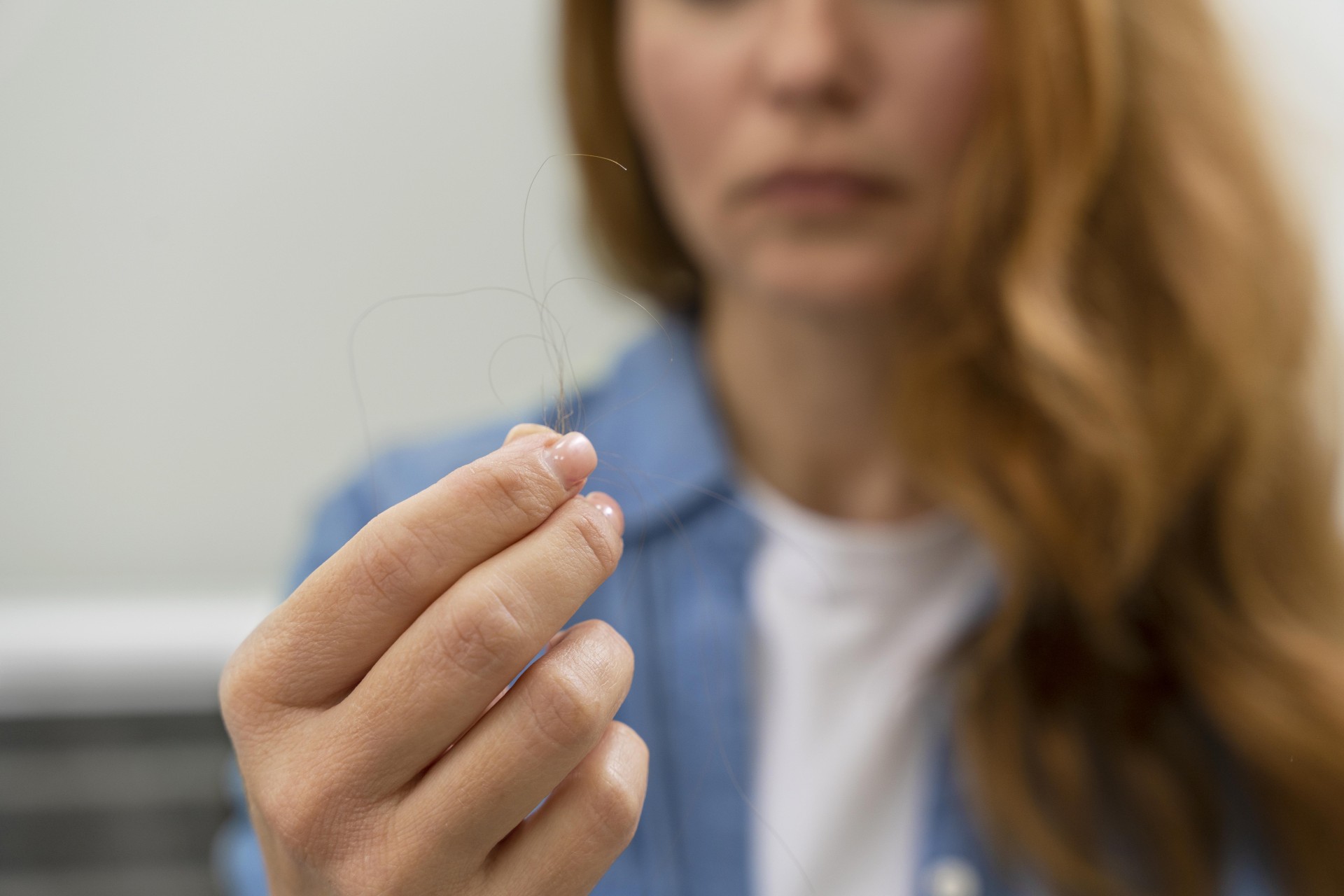 Hair Loss Support | Careplus Compounding